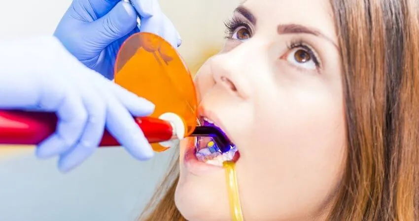 Composite bonding treatment result at Pro Estetik Dental Clinic Izmir Turkey